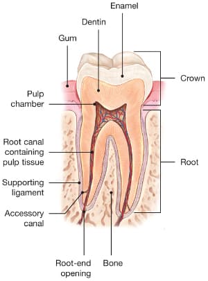 Root canal illustration